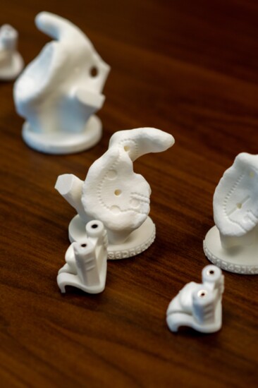 These are 3D-printed replicas of shoulder joints from Dr. Kennon's patients. 