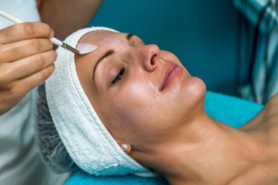 The Prefect Chemical Peel
