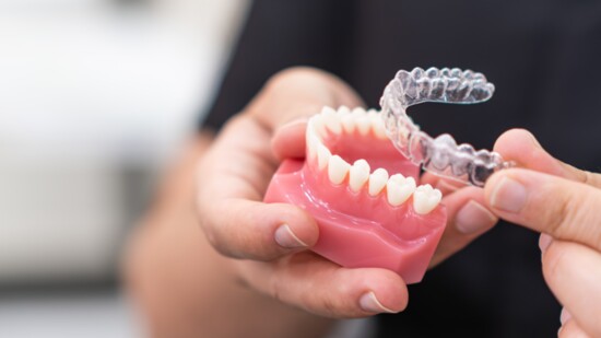 New tech like Invisalign and Spark are a discrete option to align teeth