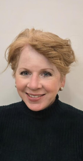 Before - Hairdreams Microlines Hair topper extensions