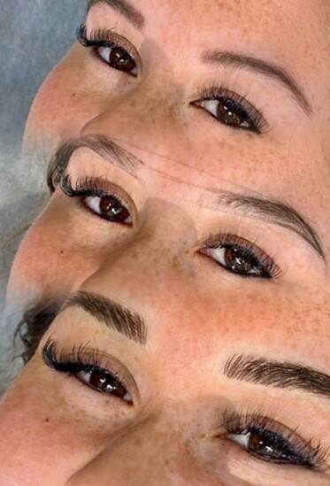Brow Progression Before to After