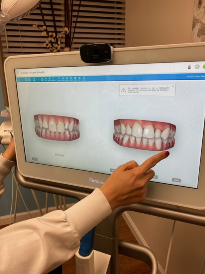 3. Software Shows Your Teeth Not Just as They Are But as They Can Be