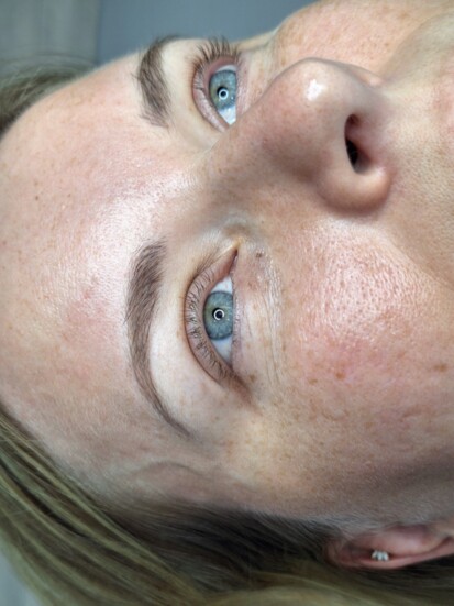 Lash Line Before