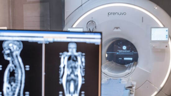 Prenuvo, the company pioneering proactive whole-body imaging for the early detection of cancer and other diseases, recently opened in River Oaks. 