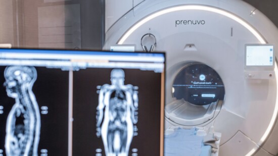 Prenuvo, the company pioneering proactive whole-body imaging for the early detection of cancer and other diseases, recently opened in River Oaks.