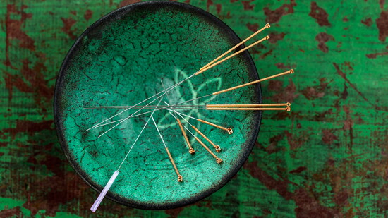 Acupuncture is a 2,000 year old practice