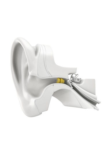 The Phonak Lyric 3 is an invisible, extended-wear device