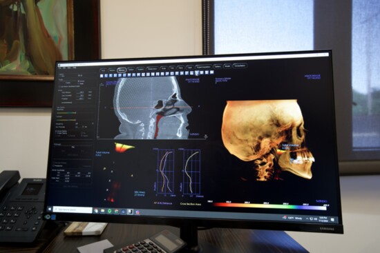 Airway dentistry focuses on how the skeletal structure of the head and oral cavity impacts our breathing, sleeping, and overall health.