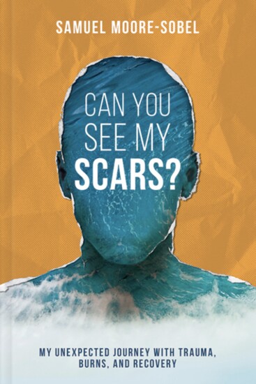 Can You See My Scars, Samuel Moore-Sobel