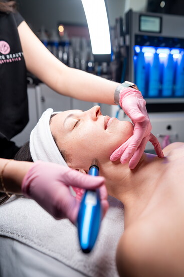 Microneedling
