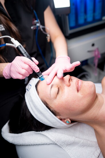 Microneedling