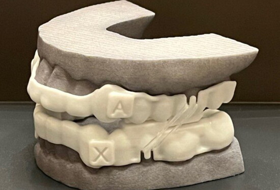 Flex 9 Oral Appliance for Sleep Apnea Treatment