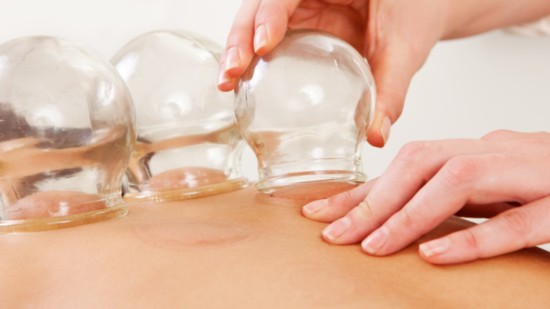Moxibustion, or cupping, is the use of heat and suction to increase qi and relieve pain naturally. 