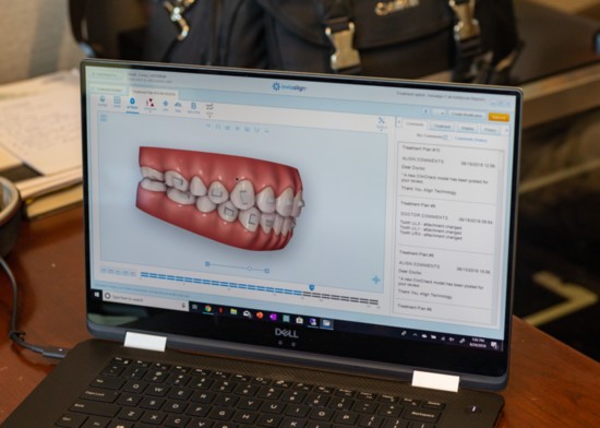 Dr. Fulks and his team use advanced software to model brace positions.