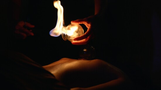 Fire cupping is available at Infusion Wellness & SPA.