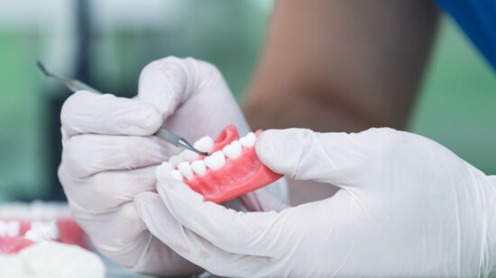 Questions About Dentures? We Have Answers