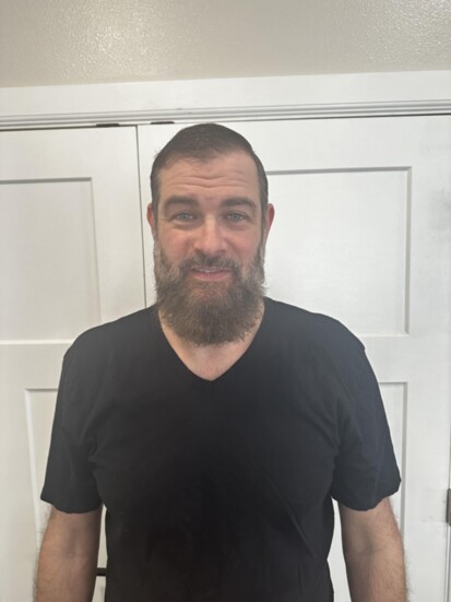 9 months post surgery