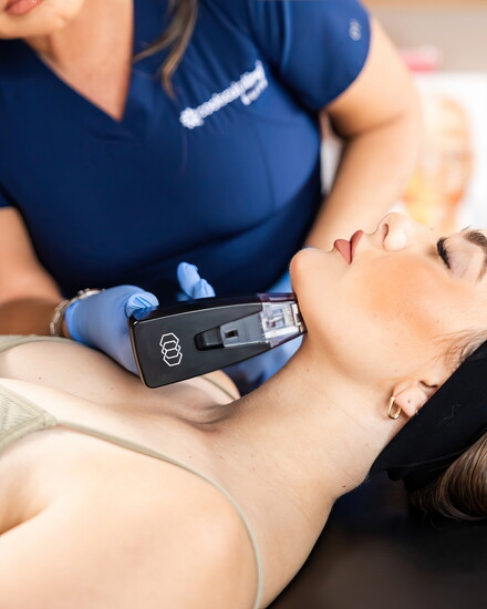 Face & Body Boutique: Morpheus8 Treatment