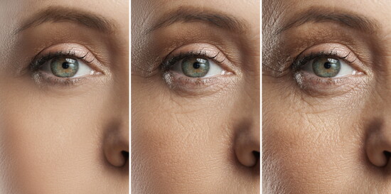 Our skin as we age loses collagen, leading to aging skin