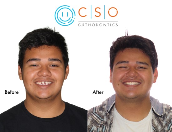 A "before and after" photo shows how orthodontic care can really brighten a smile. (Photo provided)