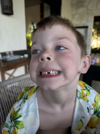 Teddy lost his tooth at Villa Cantamar.