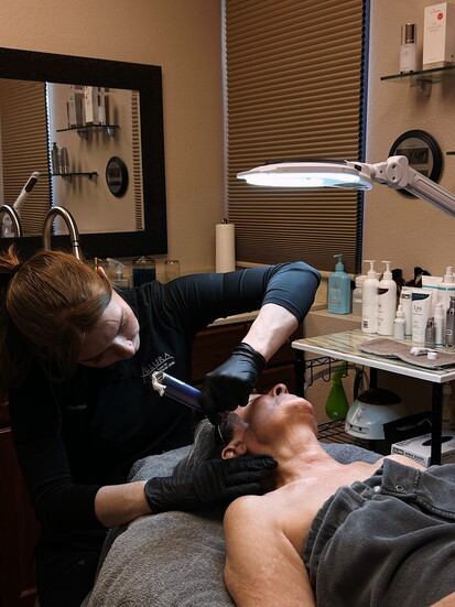 Medical Aesthetician Chelsea White microneedling a client