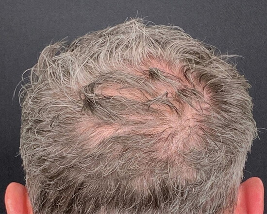 Before-Untreated