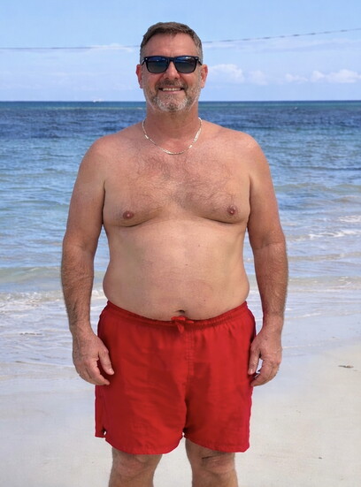Gary before use of 4Ever Young weight loss and wellness services.