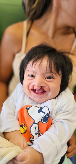 A little boy is all smiles before his cleft-palate surgery.