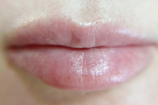 Lips Before