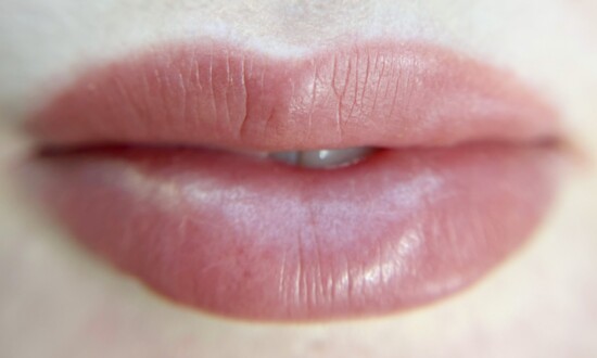 Lips After