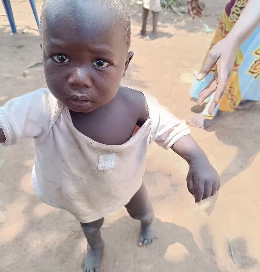 A little boy in Uganda received treatment for his clubbed feet, enabling him to walk