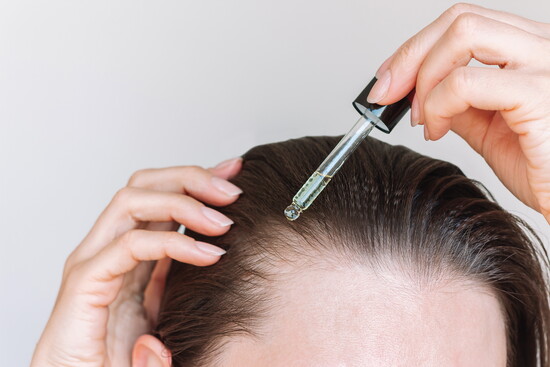 Hair Loss Therapies