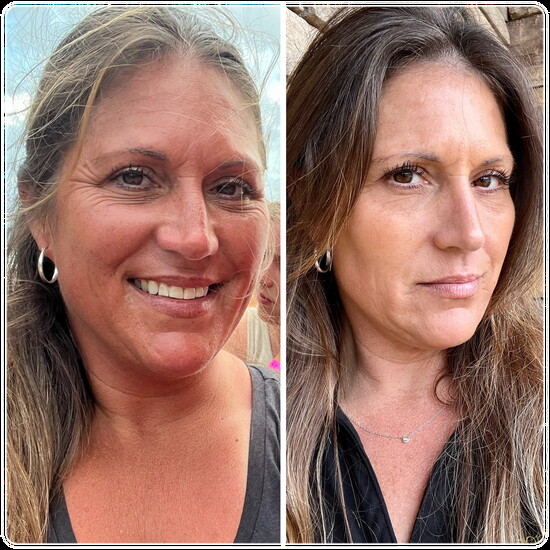 Before and After HRT and GLP weight loss treatment